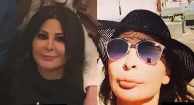 إليسا ترد بشكل مفاجئ على الساخرين من جمال شفتيها وفمها بعد عمليات التجميل!